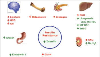resistensi-insulin